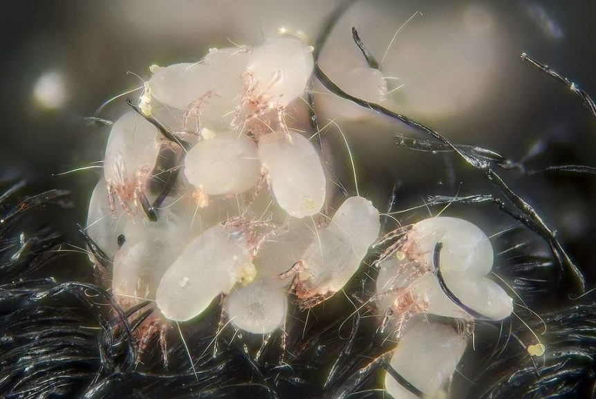 House dust mite - Dermatophagoides pteronyssinus